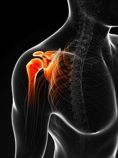Diagram of a Skeleton with Shoulder Pain